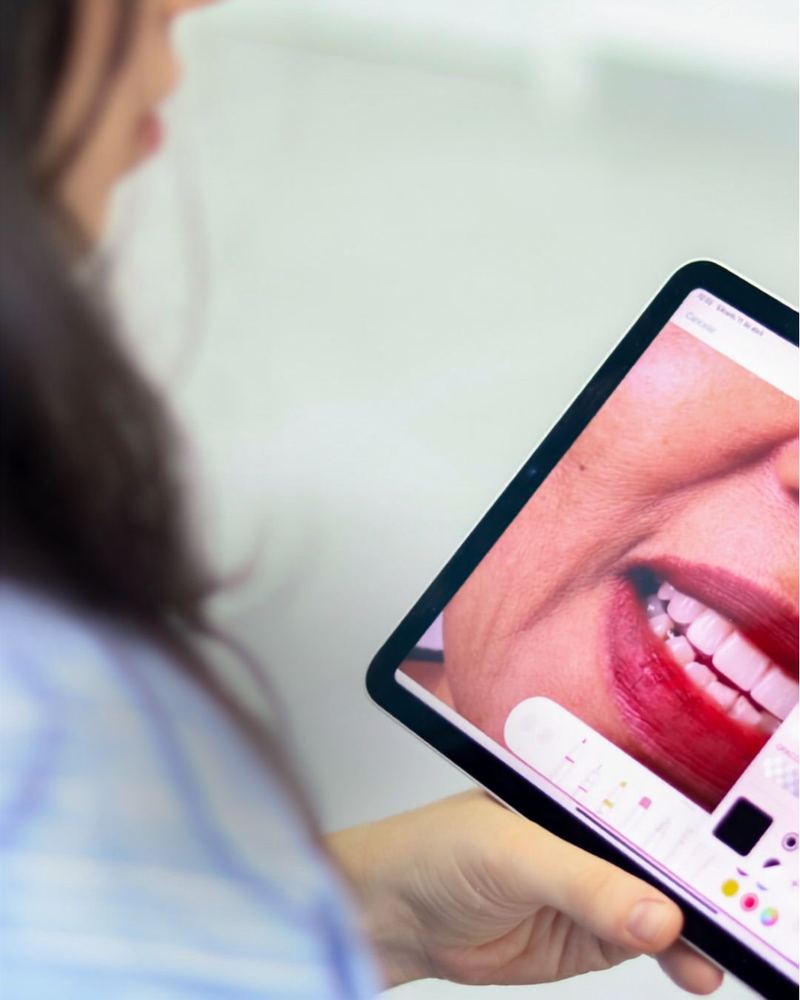 Seleção digital de cor e textura do dente para um resultado de restauração natural